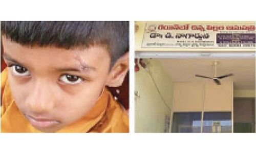 7-Year Old's Wounds Treated with Feviquick by Doctor in Gadwal