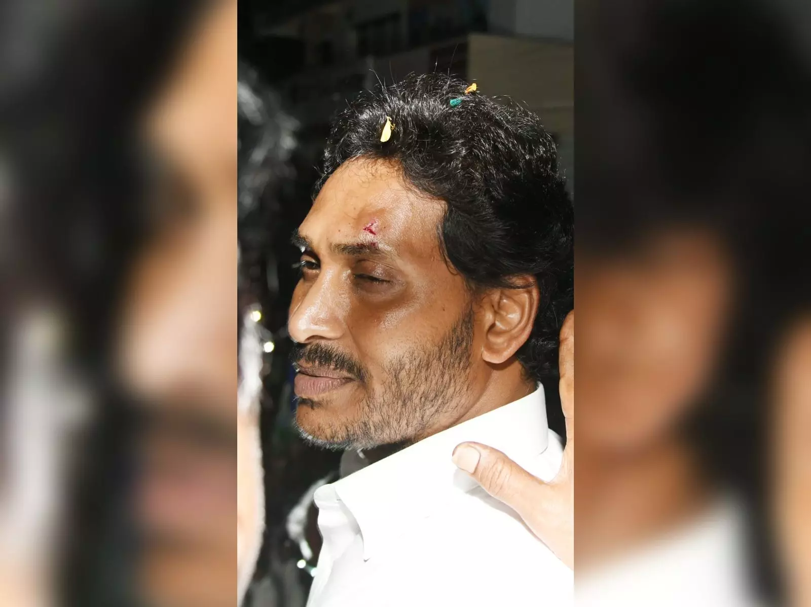 YS Jagan attacked during Memantha Siddham Yatra in Vijayawada, CM carries on with yatra after receiving first aid