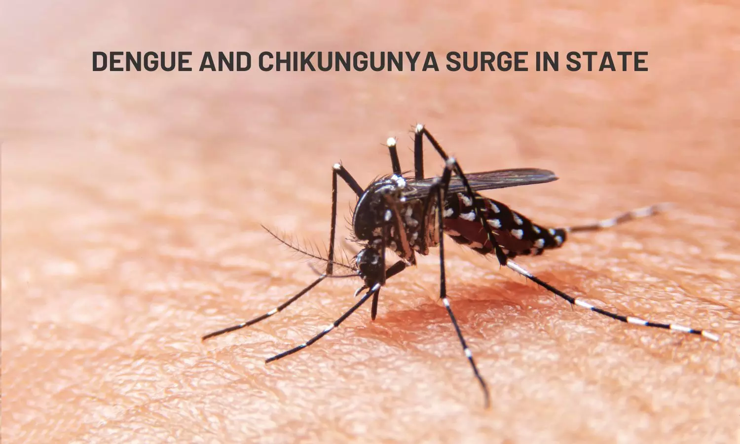 Rise in Dengue and Chikungunya Cases in Telangana