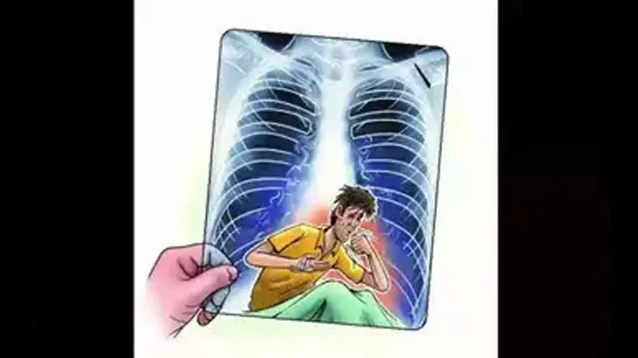 Telangana wins national award for 100-day TB elimination campaign